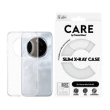 CARE by PanzerGlass Honor 400 Lite Fashionable Transparent X-Ray Soft Basic Case - Gjennomsiktig